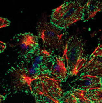 Image: Mammary epithelial cells that have undergone an epithelial-mesenchymal transition (EMT) exhibit a change in cell morphology with actin stress fibers (red) and with focused cell adhesion points (green) (Photo courtesy of Dr. Nathalie Meyer-Schaller, University of Basel).